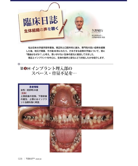 月刊アポロニア21【2026年2月号】「戦略的ワンオペ」のワザ２ ー３つの診療スタイルに学ぶ！