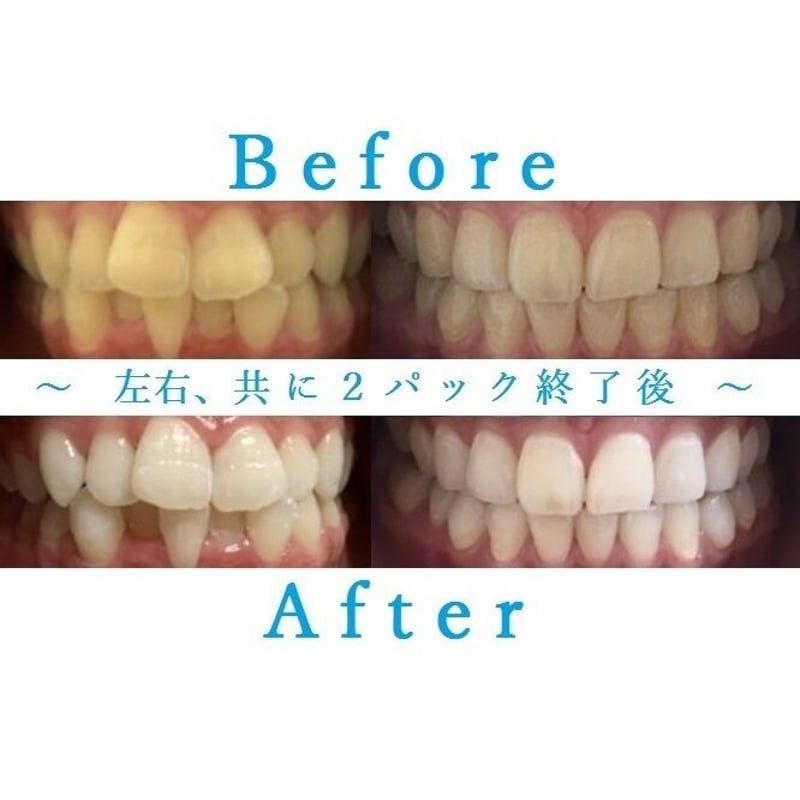 モントト様専用 WHITE 面倒くさく INQ ホワイトニング歯磨きジェル 100g