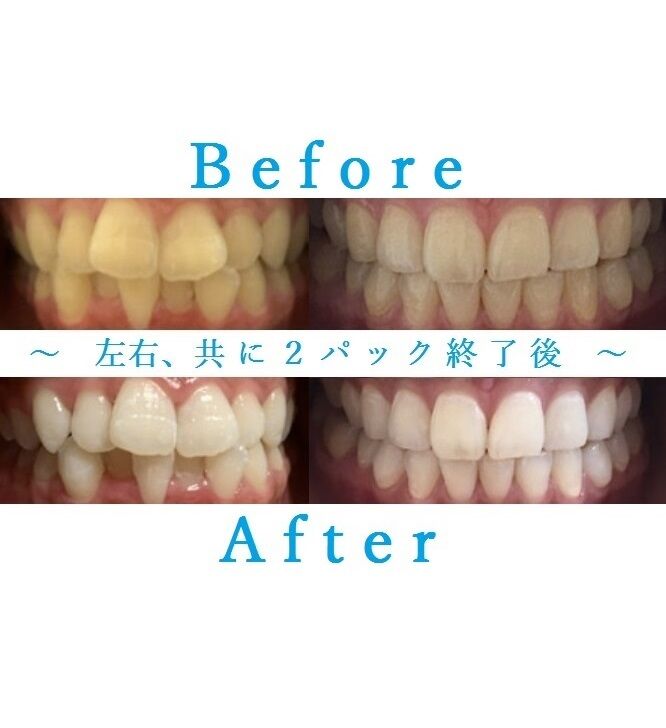ギアスページ　ホワイトニング溶液10本 fit=scale-down,w=1200