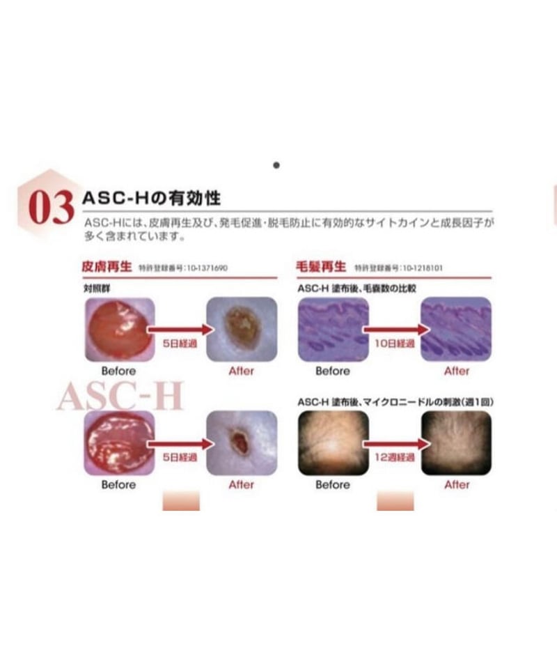 STEMLER（ステムラー）スカルプエッセンス SP 毛髪美容液 60ml | MICTH