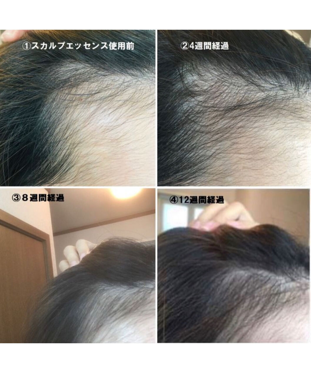 STEMLER（ステムラー）スカルプエッセンス SP 毛髪美容液 60ml | MICTH