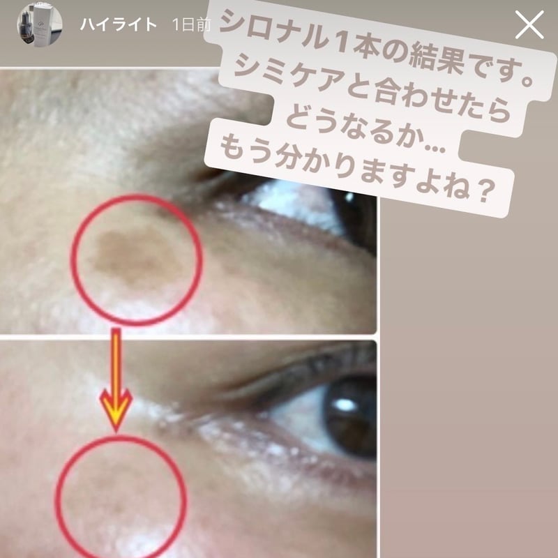 ツナグ シロナルエッセンス(美容液） | Whila STORE