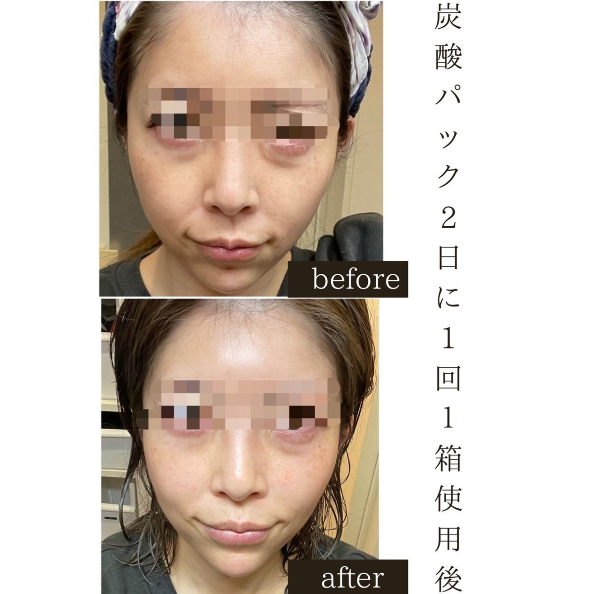メディシュティーク 世界一の炭酸ガスパック10回分 | TT Beauty メディシュティーク 世界一の炭酸ガスパック10回分 | TT Beauty
