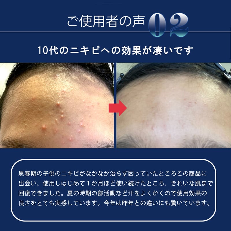 専用です ローションとスキンカバーとポンプのセット ドライセット 195gセットローションスプレー 無香料 ニューフラワー