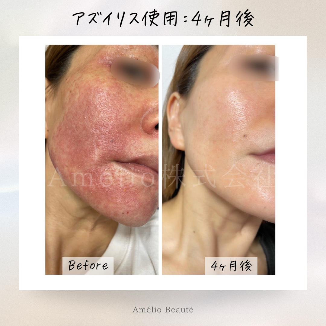 送料無料✨️最強3点セット‼️アズイリス(As_iris)+アズルクス 送料無料✨️最強3点セット‼️アズイリス(As_iris)+アズルクス