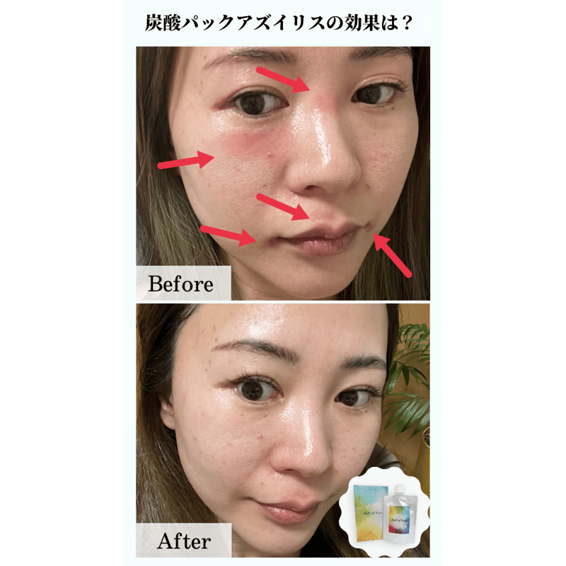 アズイリスミニ】(As_iris)炭酸ガスペーストパック アズイリスミニ】(As_iris)炭酸ガスペーストパック