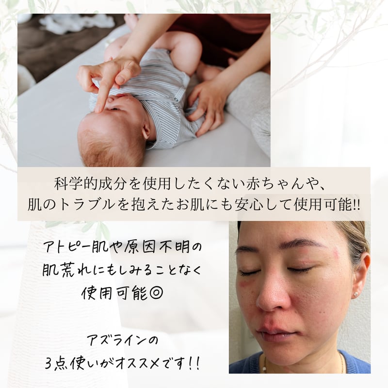 アズイリス＋アズシエル【炭酸ガスパック 肌質改善・保湿