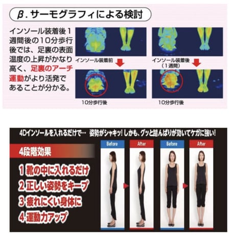 4Dインソール2セット
