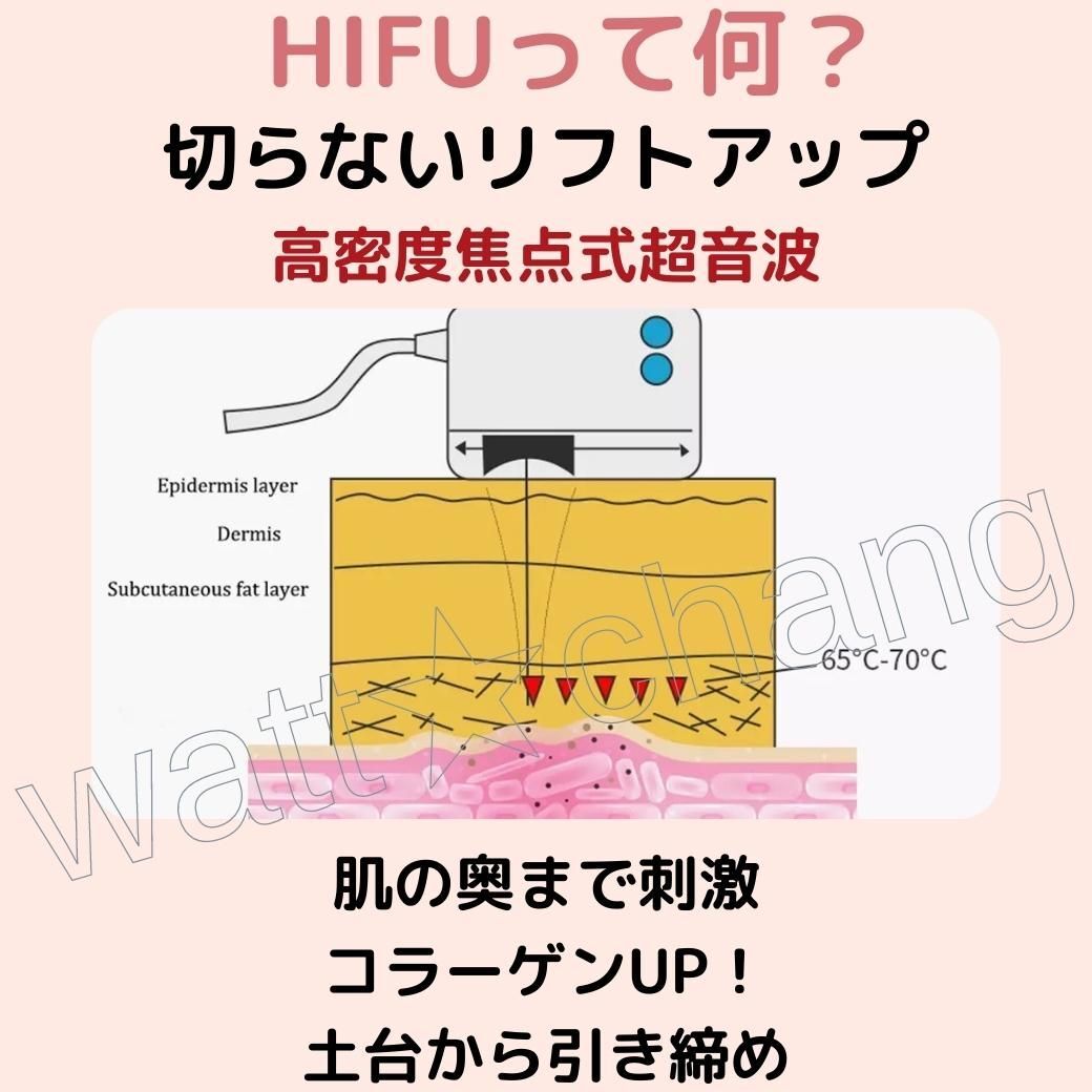 HIFU ハイフ 家庭用 美顔器 ジェル付 改善 対策 ウルセラ RF HIFU ハイフ 家庭用 美顔器 ジェル付 改善 対策 ウルセラ RF
