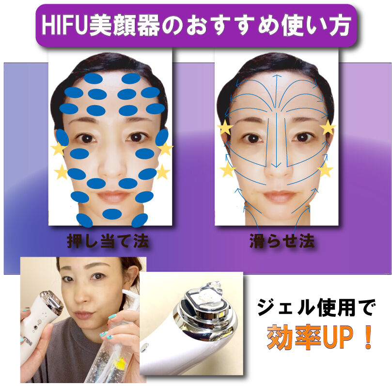 家庭用ハイフ HIFU ウルセラ