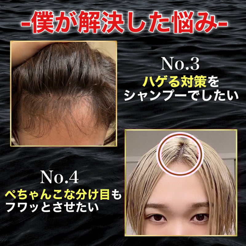 口コミ閲覧用】ME4 詰め替え用 スカルプケアシャンプートリートメント