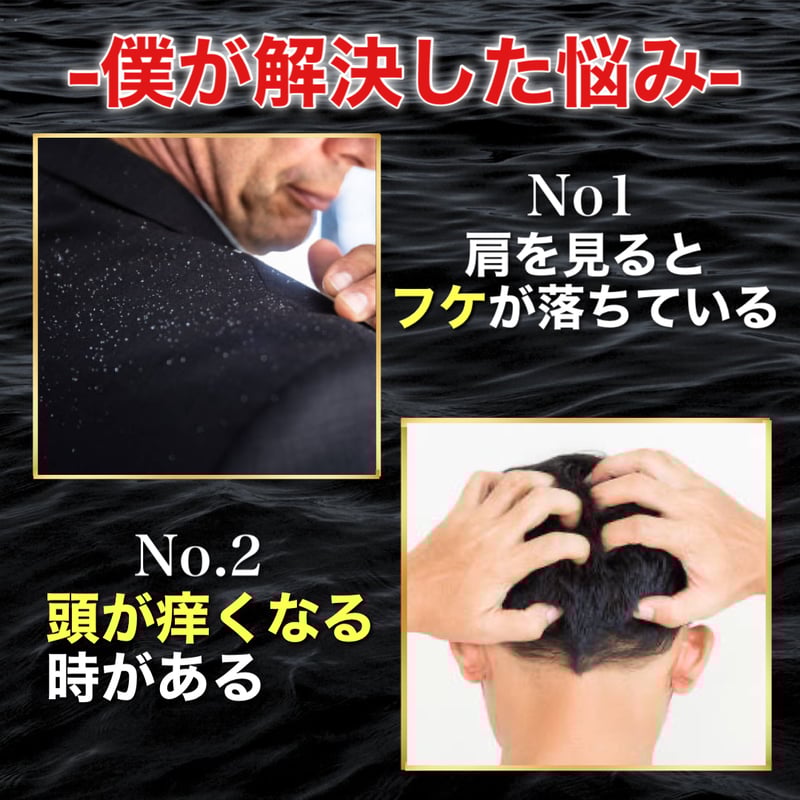 口コミ閲覧用】ME4 詰め替え用 スカルプケアシャンプー