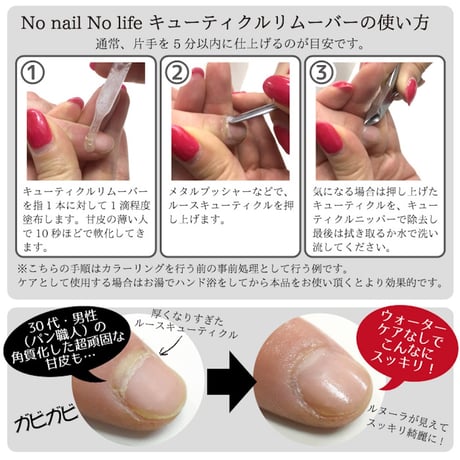 甘皮ケア キューティクルリムーバー 20ml