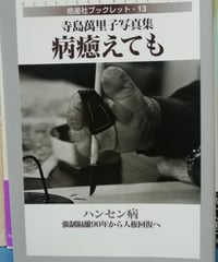 病癒えても ハンセン病・強制隔離90年から人権回復へ　寺島萬里子