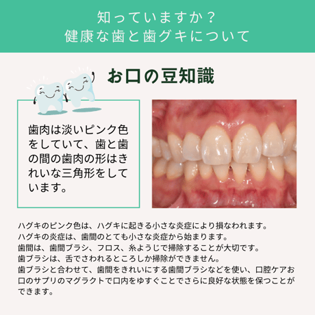 口腔ケアジェル　マグラクト
