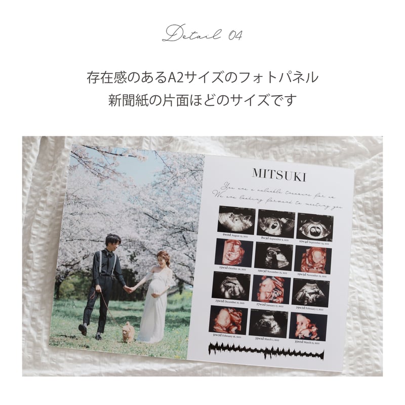 エコー写真 フォトパネル ◎A2サイズ | Hearnel