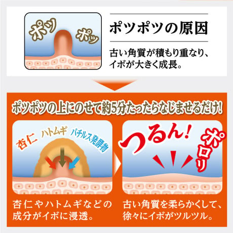 イポロン C