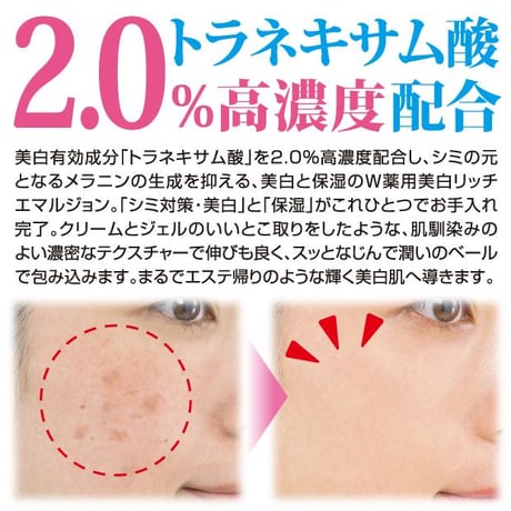薬用 トラシーミ【M】 医薬部外品 ★送料無料