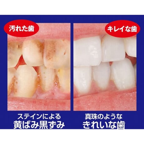 薬用重曹ステインプロ 医薬部外品