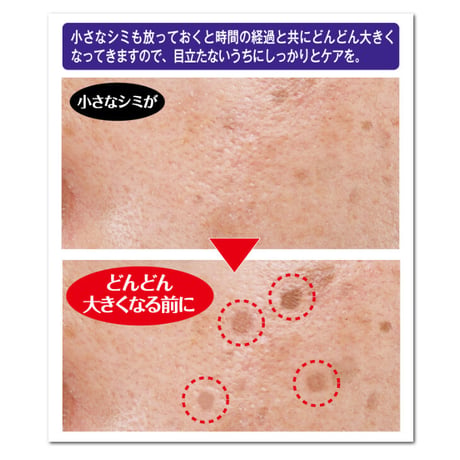 薬用シミダスパック 医薬部外品 サロン専売品