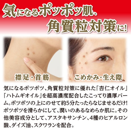 イポロン C