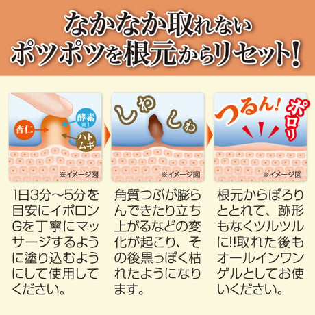 イポロンG 150g 増量版