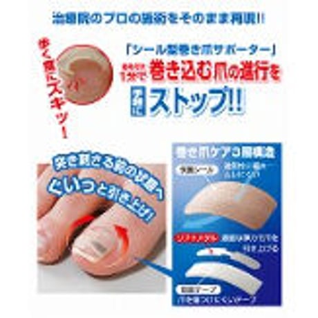 巻き爪リフトシール（1ヶ月ケア） ★送料無料