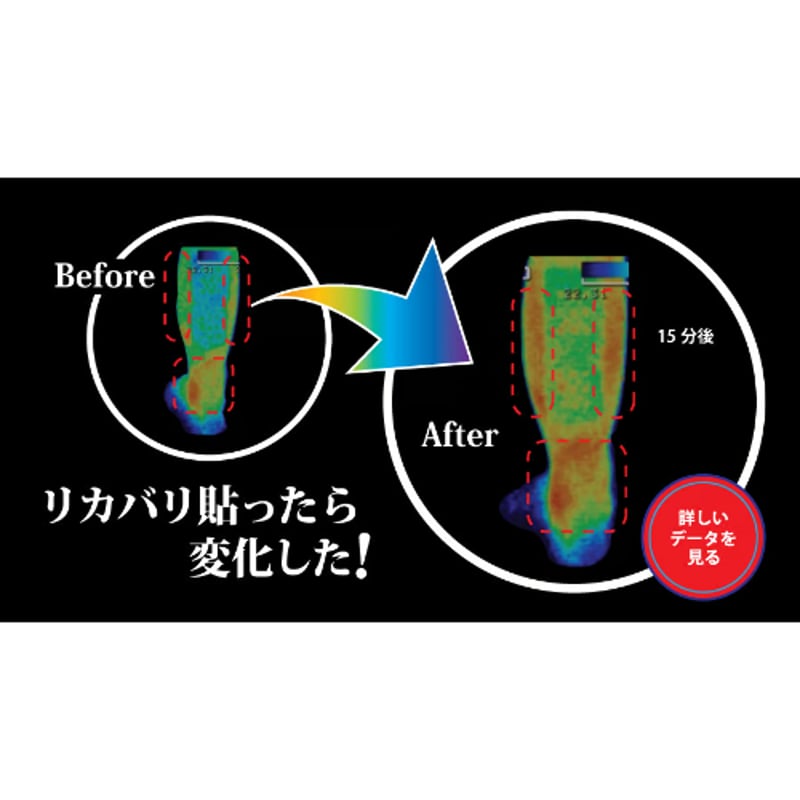 お得な5点セット！！ リカバリーテープ Mサイズ | miyagawa's STORE