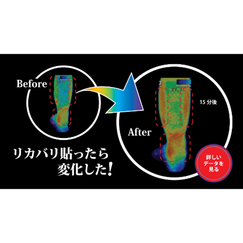 筋肉のリカバリーに特化したテーピング リカバリーテープ ブラック M