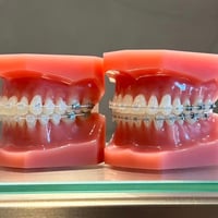 矯正歯科治療中の医療相談