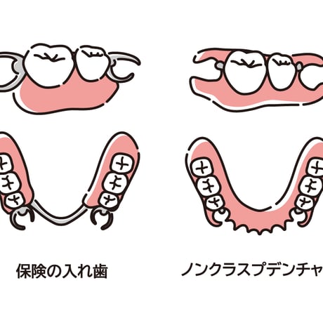 入れ歯 | STORES