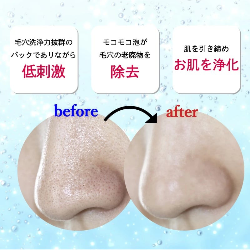 毛穴洗浄】antitox スパークリンマスク16枚セット-2か月集中ケア- | T