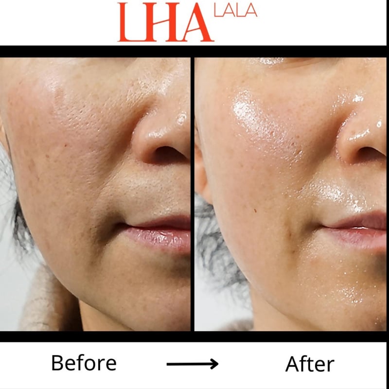 ララフィット　LALA Fit ララピール ララフィット | 業務用美容・エステ機器の卸・仕入通販は