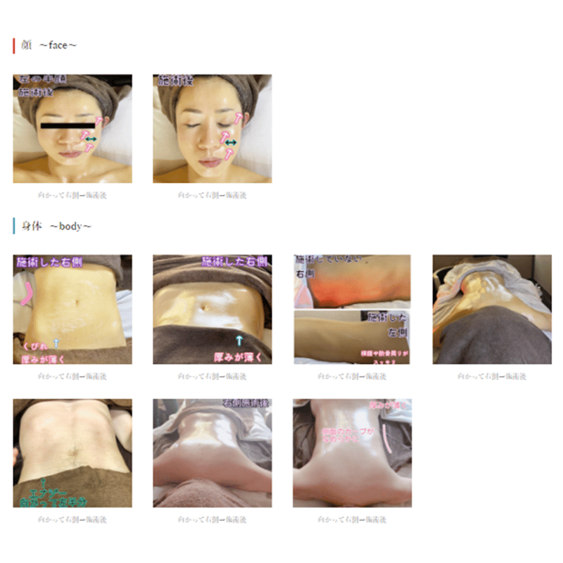 Finger E Beauty フィンガー　イー　ビューティー KBフィンガー -KB Finger- | プロ用美容エステ機器 プロ用化粧品