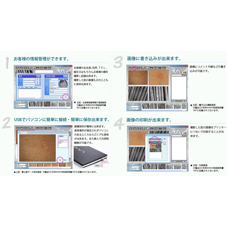 マイクロスキンスコープシステム（PC用）