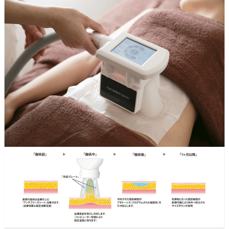 クライオモーパ -CRYO moopa- | プロ用美容エステ機器 プロ用 クライオモーパ -CRYO moopa- | プロ用美容エステ機器 プロ用