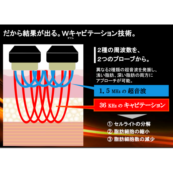 キャビゼロ -cavi ZERO- | C-PRO ONLINE STORE/プロ用美容エステ