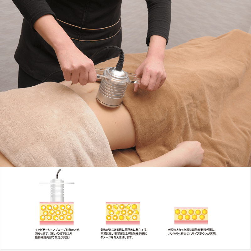 クライオモーパ -CRYO moopa- | プロ用美容エステ機器 プロ用 クライオモーパ -CRYO moopa- | プロ用美容エステ機器 プロ用