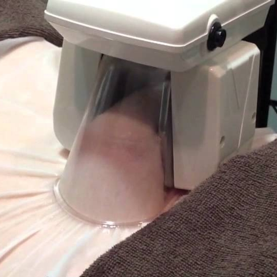 キャビクライオ2 -Cavi-CryoⅡ- | プロ用美容エステ機器 プロ用化粧品