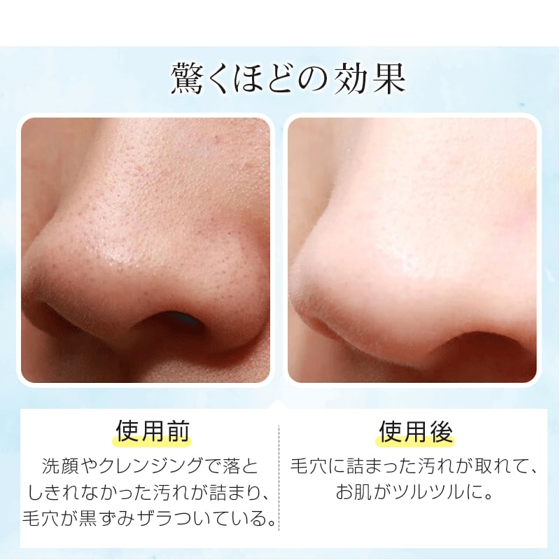水玉　白玉リフティング　毛穴　超音波　業務用 水玉スキン～高密度超音波トリートメント～® | 品川美容外科【公式】