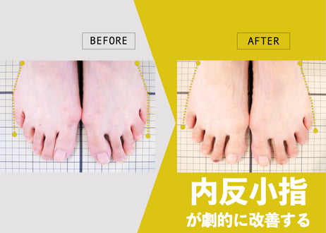 ギフトセット「慶」