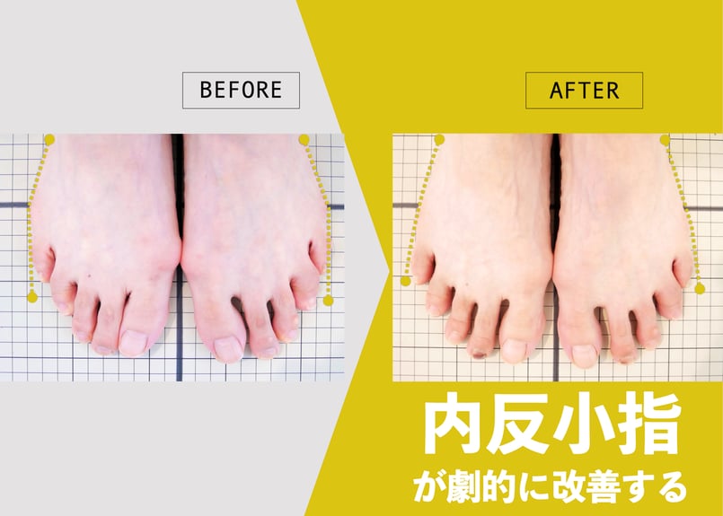 ららら　新品YOSHIRO ヨシローソックス ５足組　M 20-25cm ららら 新品YOSHIRO ヨシローソックス 5足組 M 20-25cm 2025年