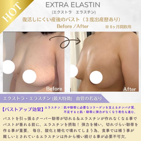 美胸キーププレミアムセット【3ヶ月分】