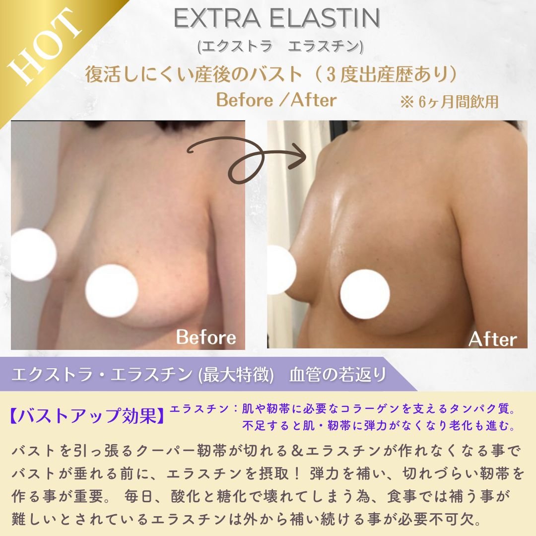 新品バストアップセット　プロテイン　エラスチン　鉄　ビタミン　育乳　バストケア 美胸キーププレミアムセット【3ヶ月分】 | RAVIS