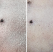 驚きの保湿力！ N's drive スキンバリア・ヴィア 150ml | Dog's Pant