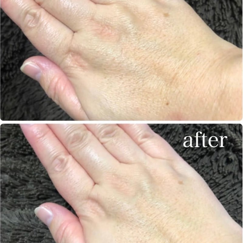 大容量！200グラム】MOCCHI ヒト幹細胞入り美肌クリーム | HANA HANA