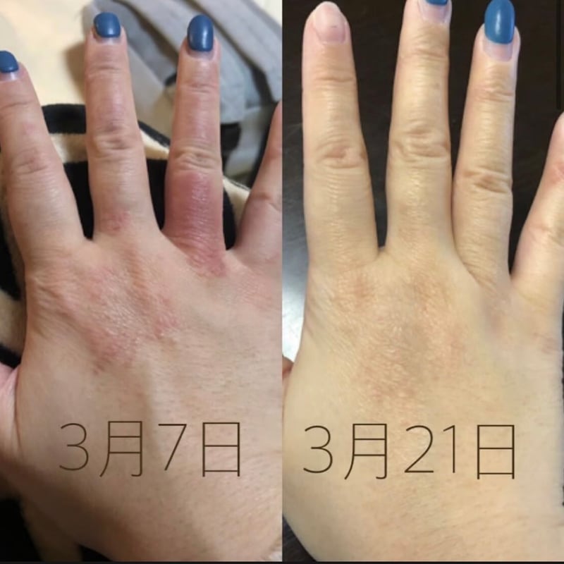 大容量！200グラム】MOCCHI ヒト幹細胞入り美肌クリーム | HANA HANA