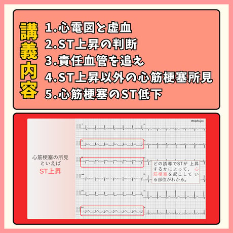 心電図検定3.4級対策動画セット ーコンプリートセットー