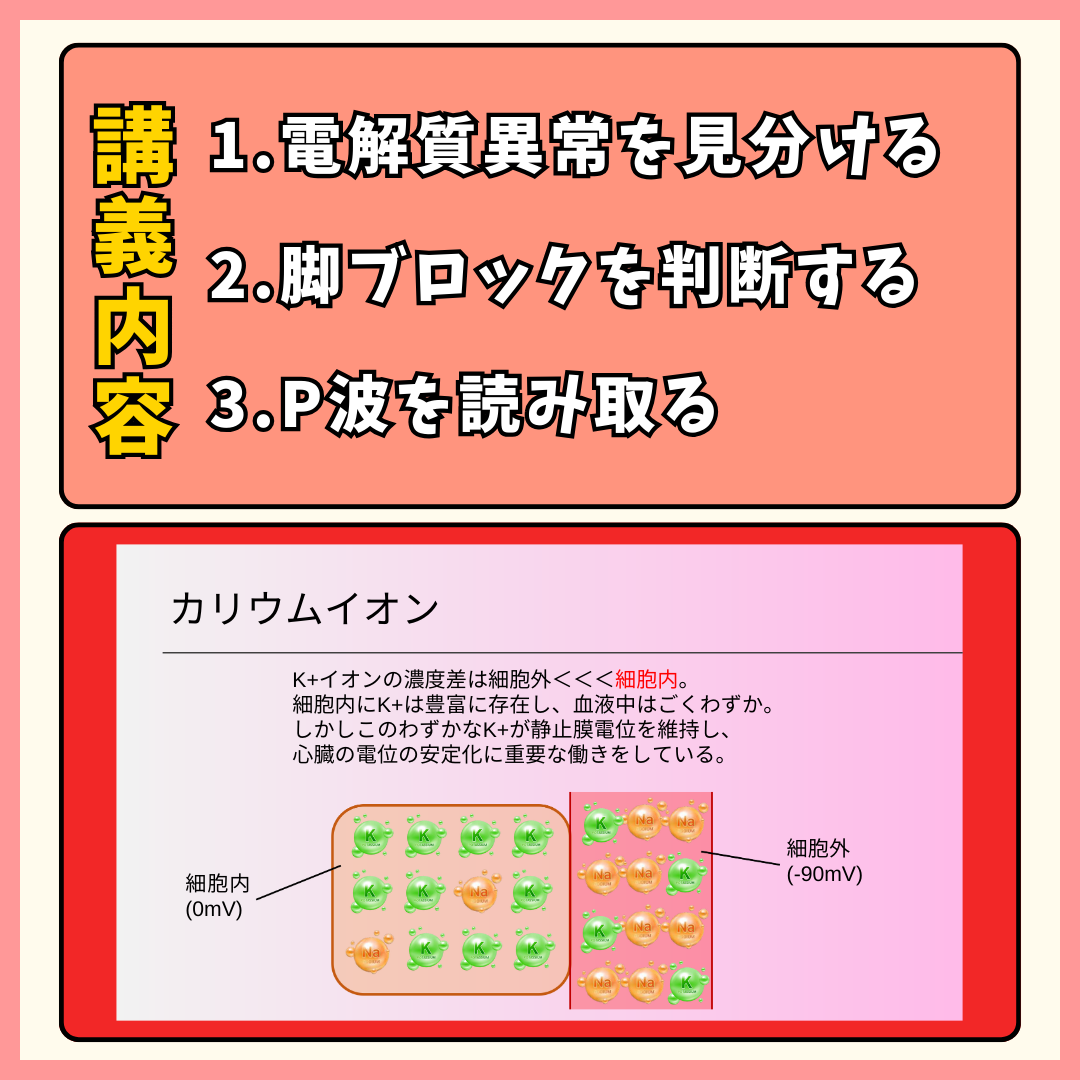 新・わかる!!　シリーズ◆血液ガス/水・電解質/心電図　3テーマ　DVD 心電図検定3.4級対策動画単品 ー⑥電解質異常ー | ナースタショップ