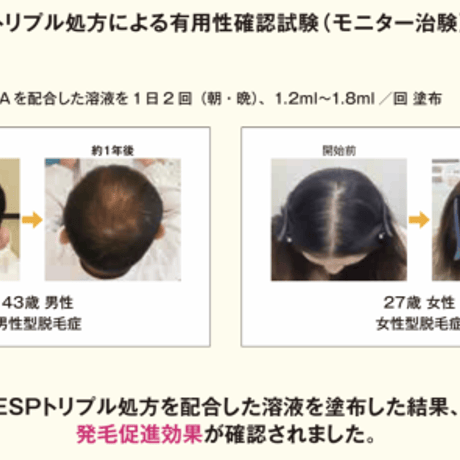 育毛用ヘアエッセンス◆ゼウスゼロトゥワン◆ZeUS「0 to 1」